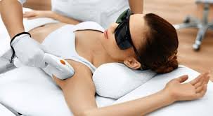 Лазерна епіляція пахви