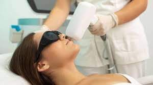 Лазерна піляція обличчя