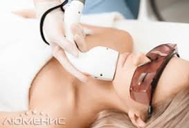 лазерна епіляція підборіддя