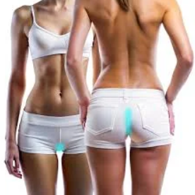 Лазерна епіляція екстра бікіні