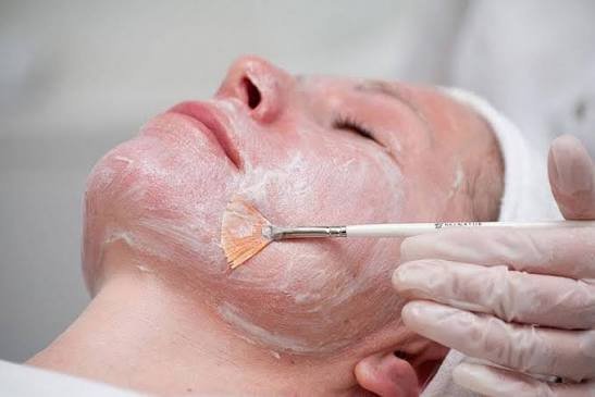 Пілінг Азелаіновий фіто-пілінг