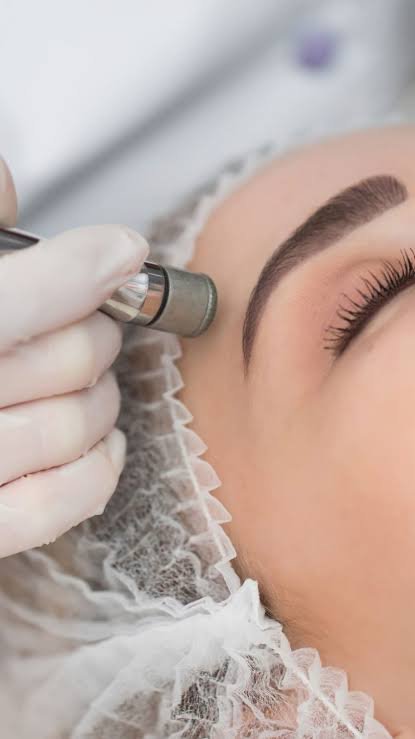 Діамантова мікродермабразія чистка