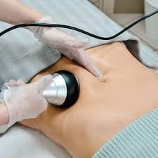 Кавітація (розчеплення жирів)